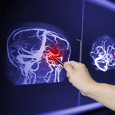 Person pointing to brain diagram