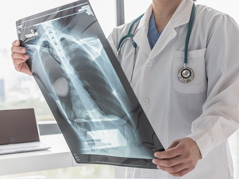Respiratory Conditions _ Pulmonary Hypertension